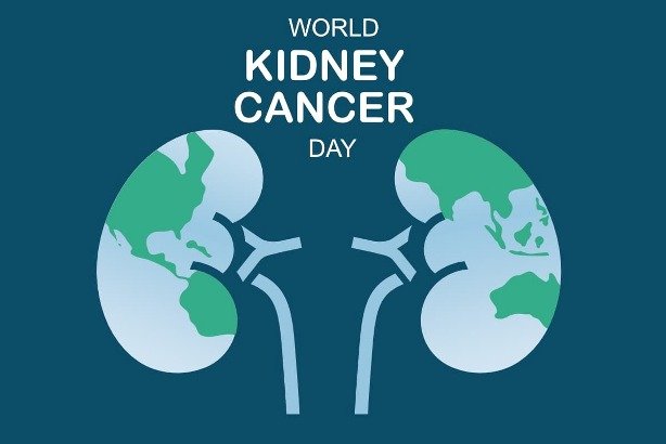 Kidney cancer is among the 10 most common cancers in the world